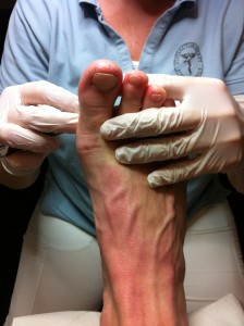 Fodterapeut Malene Schmøde er i gang med fodbehandling, så mine fødder kan blive ved med at være glade fødder :-)